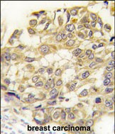 14 - SEMA3E Antibody (C-term) AP7976b