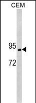 1 - SEMA3E Antibody (C-term) AP7976b