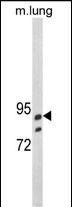 1 - SEMA3E Antibody (C-term) AP7976b