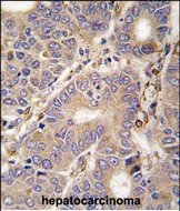 14 - CARS2 Antibody (C-term) AP7846b