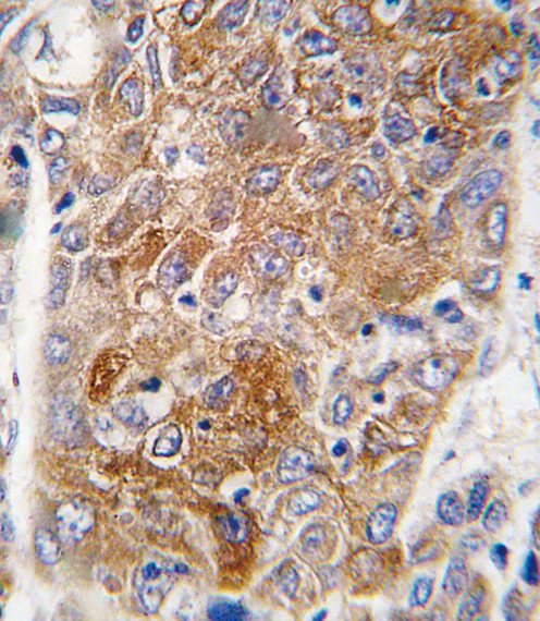 14 - ALDH1L1 Antibody (C-term) AP7848B
