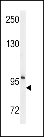 1 - ENPP2 Antibody (Center K416) AP2854C
