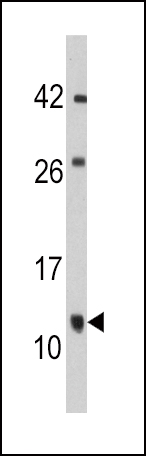 1 - FKBP1B Antibody (N-term E6) AP7868a