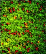 3 - DPT Antibody (Center) AP7485c