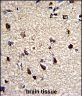 14 - DPT Antibody (Center) AP7485c