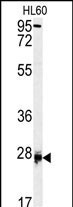 1 - DPT Antibody (Center) AP7485c