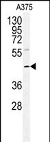 1 - POLDIP2 Antibody (Center) AP7626c