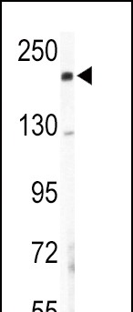 1 - COL5A2 Antibody (N-term) AP7358a