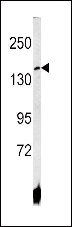 1 - ATP7B Antibody (C-term) AP6504B