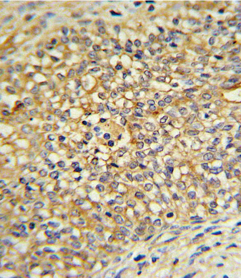 14 - UDB17 Antibody (Center) AP6505c