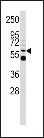 1 - UDB17 Antibody (Center) AP6505c