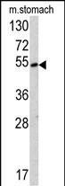 1 - SUV4-20H2 Antibody (Center) AP6511C