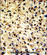 14 - DCL-1 Antibody (Center) AP6522c