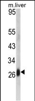 1 - DCL-1 Antibody (Center) AP6522c