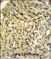 14 - FKBP14 Antibody (N-term) AP6572a