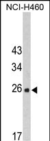 1 - FKBP14 Antibody (N-term) AP6572a