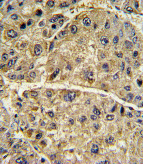 14 - COL6A1 Antibody (N-term) AP6587A