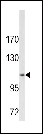 1 - COL6A1 Antibody (N-term) AP6587A