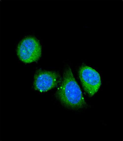 3 - ASPN Antibody (Center) AP6604C