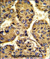 14 - ASPN Antibody (Center) AP6604C