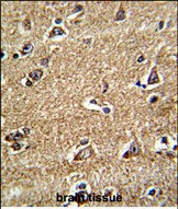 14 - RAB13 Antibody (Center) AP6667c