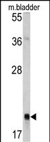 1 - RAB13 Antibody (Center) AP6667c