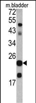 1 - TAGLN Antibody (C-term) AP6678b
