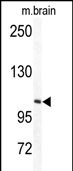 1 - TECPR1 Antibody (C-term) AP7391b
