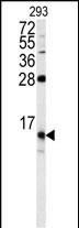 1 - FKBP1B Antibody (N-term) AP7868d
