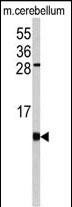 1 - FKBP1B Antibody (N-term) AP7868d