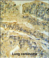 14 - FKBP2 Antibody (N-term) AP6730a