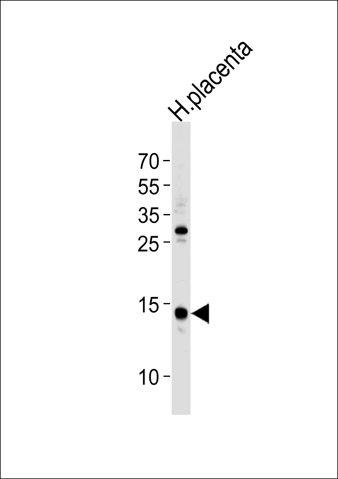 1 - FKBP2 Antibody (N-term) AP6730a