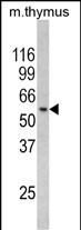 1 - CHC1L Antibody (N-term) AP6741a