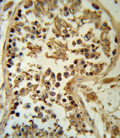 14 - SMYD3 Antibody (N-term) AP7344a