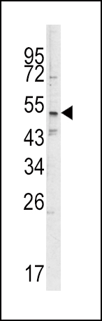 1 - SMYD3 Antibody (N-term) AP7344a