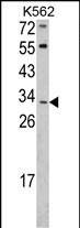 1 - ITM2A Antibody (N-term) AP6765a