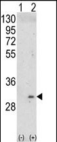 1 - ITM2A Antibody (N-term) AP6765a