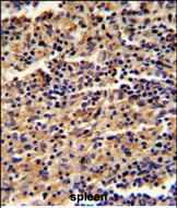 14 - ALKBH8 Antibody (C-term) AP6801b