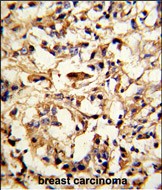 14 - DFNA5 Antibody (N-term) AP6842A