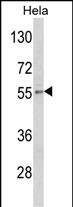 1 - DFNA5 Antibody (N-term) AP6842A