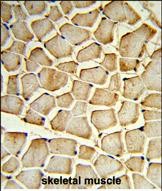 14 - PIK4CB Antibody (Center) AP6948c