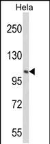 1 - PIK4CB Antibody (Center) AP6948c