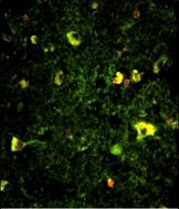 3 - Rab5 Antibody (C-term) AP6974B
