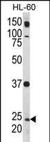 1 - Rab5 Antibody (C-term) AP6974B