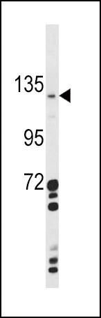 1 - CLEC16A Antibody (Center) AP6983c