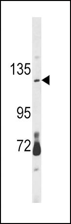 1 - CLEC16A Antibody (Center) AP6983c