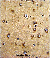 14 - HOMER3 Antibody (Center) AP6992c