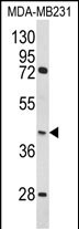 1 - HOMER3 Antibody (Center) AP6992c