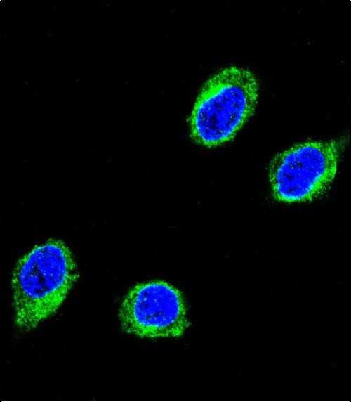 3 - CCHCR1 Antibody (Center) AP8528C