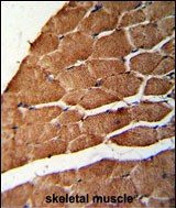 14 - CCHCR1 Antibody (Center) AP8528C
